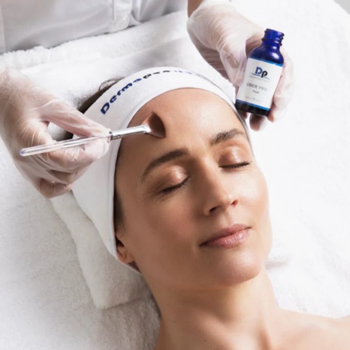 Uber Peel Deemaceuticals Wattrelos peeling acné imperfections