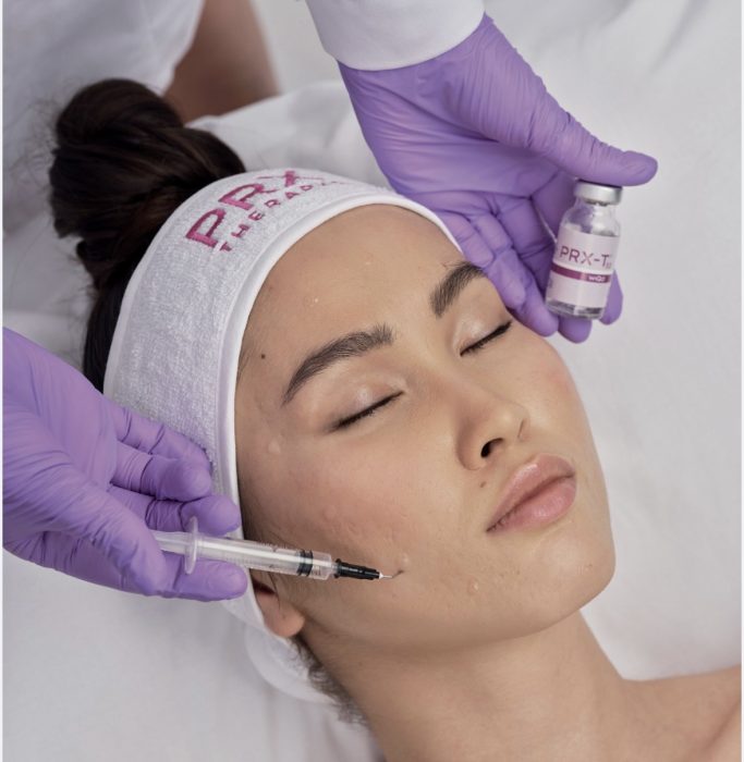 peeling PRX-T33 Wattrelos soin peau éclat infirmière